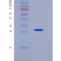 人Mesothelin/MSLN/CAK1/MPF重组蛋白C-6His