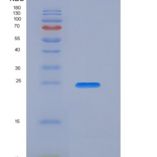 人激肽释放酶4(KLK4)重组蛋白His tag