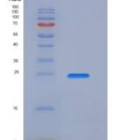 人激肽释放酶4(KLK4)重组蛋白His tag