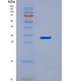 人FCRL1重组蛋白His Tag