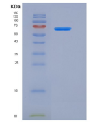 大鼠白介素18受体1(IL18R1)重组蛋白Fc tag