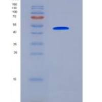 小鼠博来霉素水解酶(BLMH)重组蛋白His tag