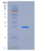 人激肽释放酶4(KLK4)重组蛋白His tag