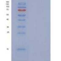 人S100A1重组蛋白