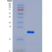 人TNFRSF1A重组蛋白His Tag