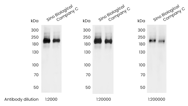 蛋白磷酸化研究和选对抗体究竟是什么关系？