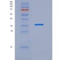 人S100钙结合蛋白B(S100B)重组蛋白Fc tag