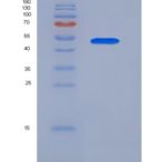 人LILRB4/CD85k/ILT3重组蛋白Fc Tag