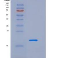 人REG3G / PAP1B重组蛋白His tag