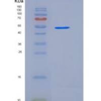 人BPIFB1 / LPLUNC1重组蛋白His tag