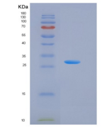 人激肽释放酶13(KLK13)重组蛋白His Tag