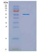 人P4HB重组蛋白His Tag