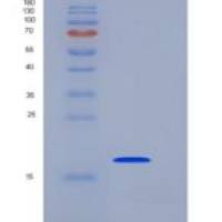 人SETD8 / PR-Set7重组蛋白