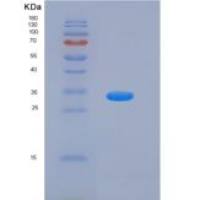 人锌结合α2-糖蛋白1(aZGP1)重组蛋白His tag