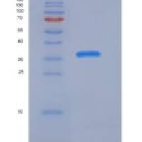 人S100A1重组蛋白Fc tag