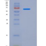 大鼠白介素18受体1(IL18R1)重组蛋白Fc tag
