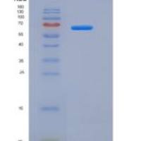 大鼠白介素18受体1(IL18R1)重组蛋白Fc tag