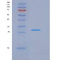 人14-3-3 sigma / Stratifin / YWHAS重组蛋白