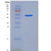 人白介素17受体C(IL17RC)重组蛋白aa 1-454, His tag