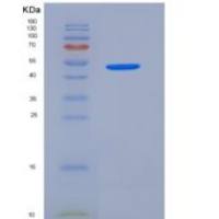 人白介素17受体C(IL17RC)重组蛋白aa 1-454, His tag