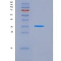 人CD155 / PVR重组蛋白His tag