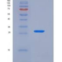 人PD-L1 / B7-H1 / CD274重组蛋白His tag