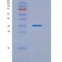 人精氨酸酶(ARG)重组蛋白His & MYC Tag