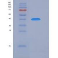 人跨膜蛋白27(TMEM27)重组蛋白Fc tag