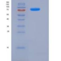 人内皮素转化酶2(ECE2)重组蛋白His tag