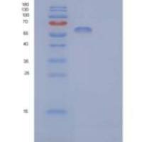 人IL3RA / CD123重组蛋白His & Fc tag