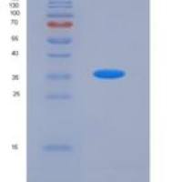 人ALK-1 / ACVRL1重组蛋白Fc tag