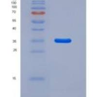 小鼠组织蛋白酶H(CTSH)重组蛋白His Tag