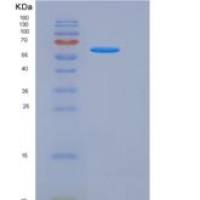 人DLL1 / Delta-1重组蛋白His tag