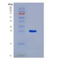 小鼠IFNGR2重组蛋白His tag