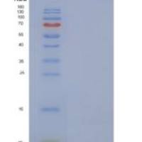 人SPINK4重组蛋白His Tag