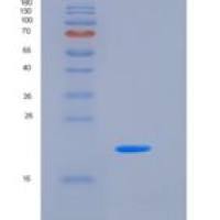 人低亲和力免疫球蛋白γFc区受体II-B重组蛋白