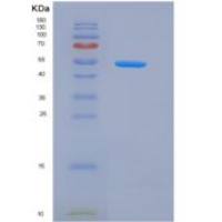 人CXADR / CAR重组蛋白His & Fc tag