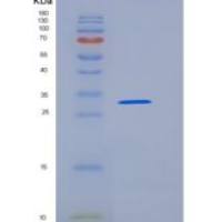 人SCARB3重组蛋白His & FLAG tag