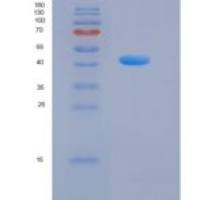 大鼠XEDAR / EDA2R重组蛋白Fc tag