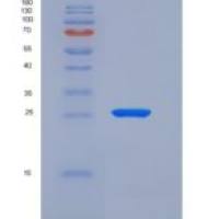 人内皮细胞粘附分子(ESAM)重组蛋白His tag