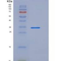 大鼠IL17RA / IL17R重组蛋白His tag