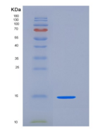 小鼠ACVR2A / ActrIIa重组蛋白His tag