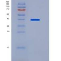 人SIRP alpha / CD172a重组蛋白His tag
