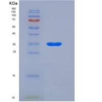 小鼠CADM3 / NECL1 / IGSF4B重组蛋白His tag
