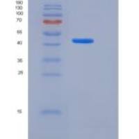 人HAI-1 / SPINT1重组蛋白His tag