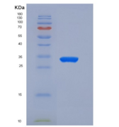人CEACAM6 / CD66c重组蛋白His tag