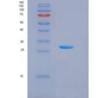 人激肽释放酶13(KLK13)重组蛋白His Tag