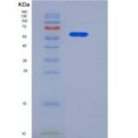 人CD146 / MCAM重组蛋白His tag