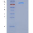 人VEGFR3 / FLT4重组蛋白Fc tag