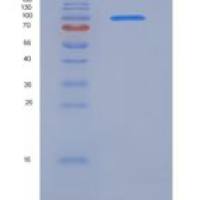 人VEGFR3 / FLT4重组蛋白Fc tag